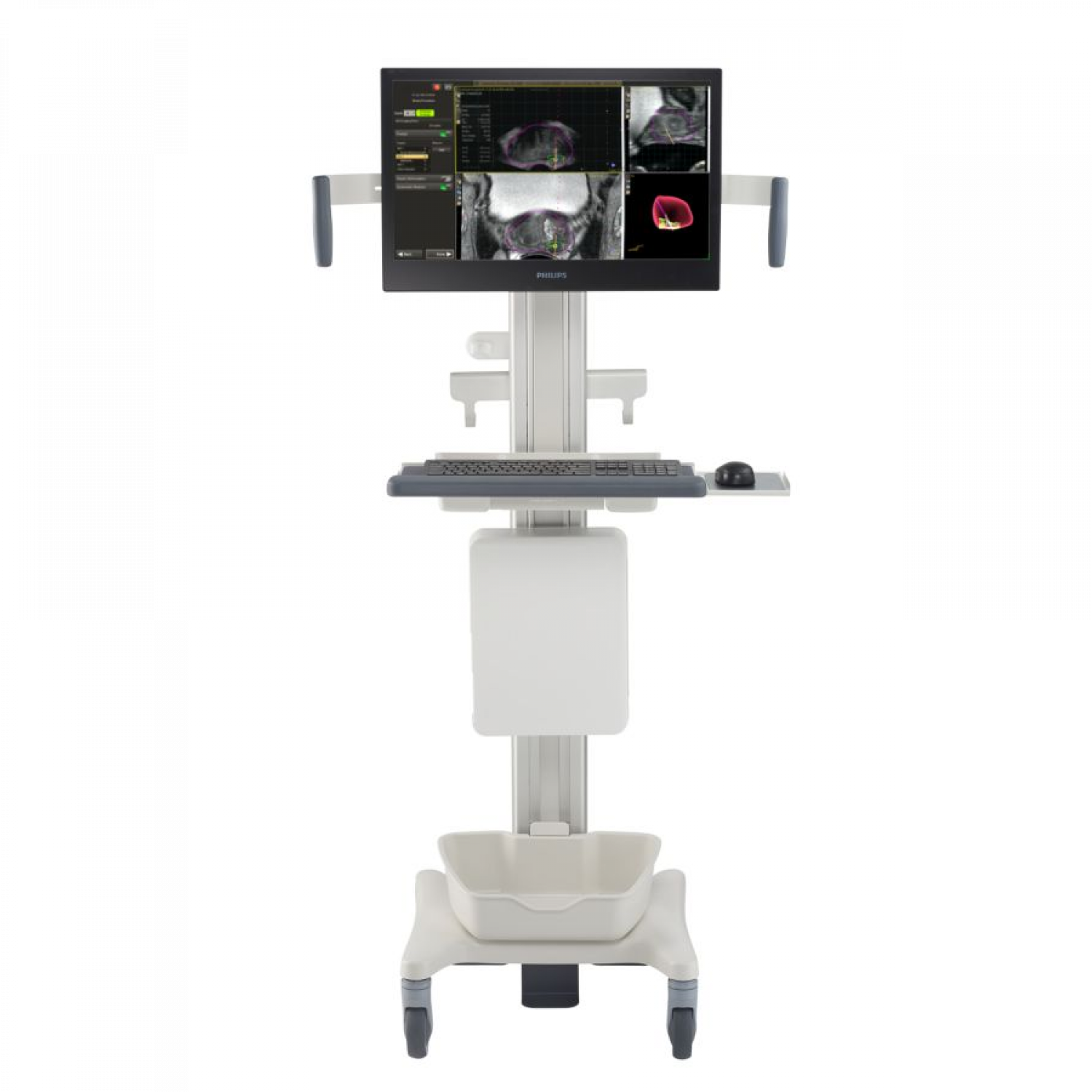 st louis cancer diagnosis centers